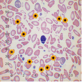 Ruvalcaba syndrome