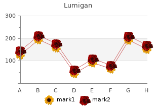 order lumigan 3ml free shipping
