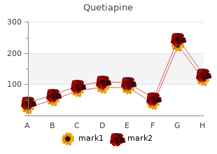 purchase quetiapine 300 mg fast delivery