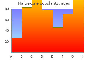 purchase naltrexone 50mg online