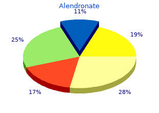 order alendronate amex