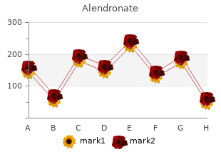 purchase genuine alendronate on line