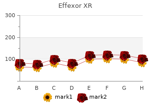 purchase generic effexor xr