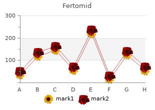 50mg fertomid with mastercard