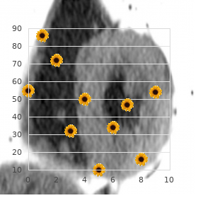 Hyperferritinemia, hereditary, with congenital cataracts