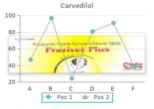 order discount carvedilol line