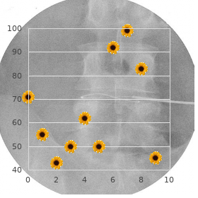 Thiolase deficiency