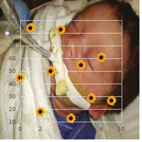Splenogonadal fusion limb defects micrognatia